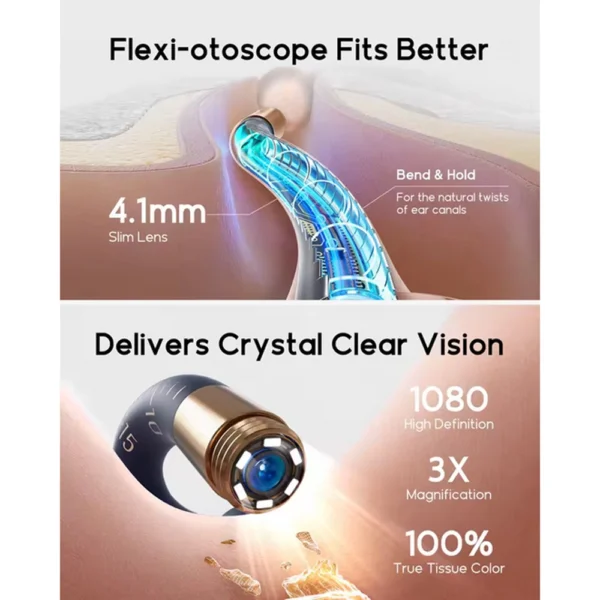 اتوسکوپ و گوش پاکن بی برد Bebird EAR-CARE sight plus I35R - Image 6