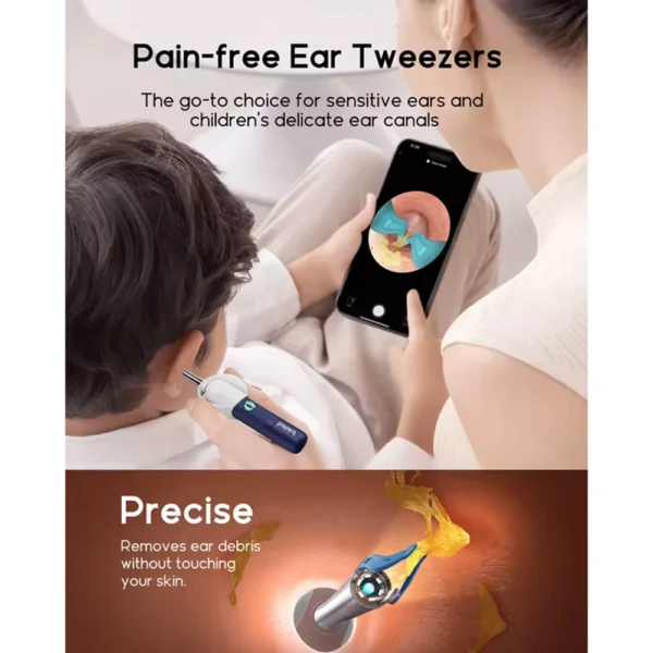 اتوسکوپ و گوش پاکن بی برد Bebird EAR-CARE sight plus I35R - Image 7